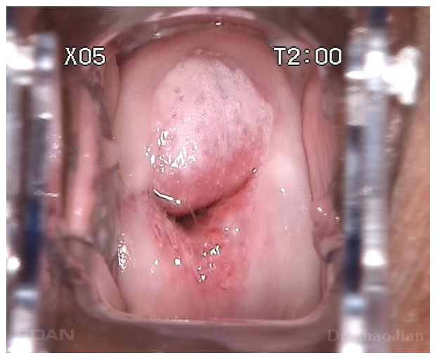 Матрица SONY CCD