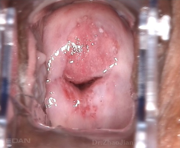 Матрица SONY CCD