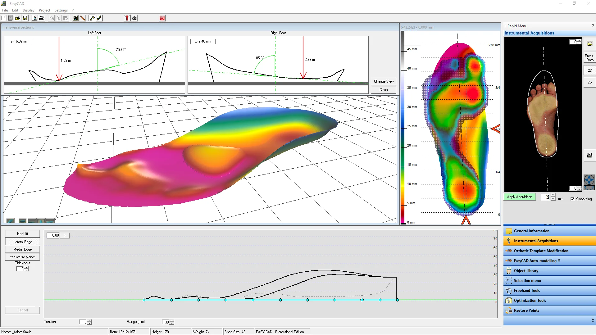 easyCAD Insole - изображение №2