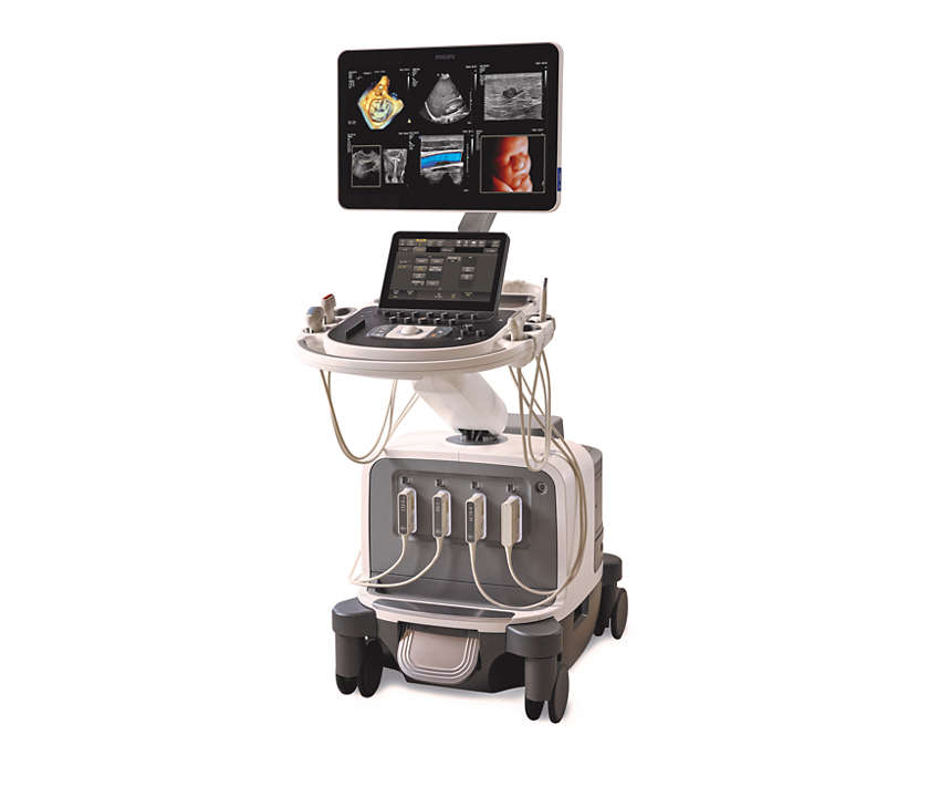 Philips EPIQ Elite