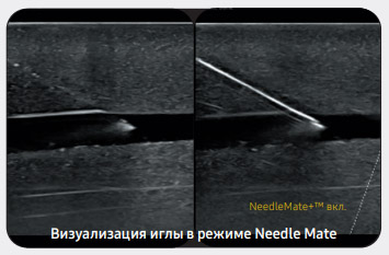 NeedleMate.jpg