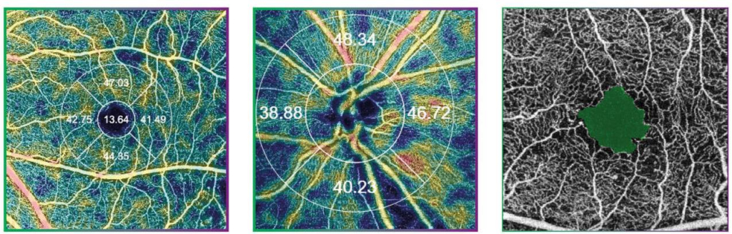 retinal-vasulature.jpg