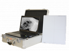 Мобильная беcпроводная система для цифровой рентгенографии SCOPE Ultralight