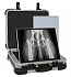 Мобильная беспроводная система для цифровой рентгенографии SCOPE TOUCH1
