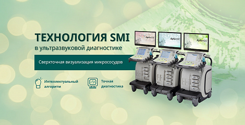 Технология SMI в ультразвуковой диагностике