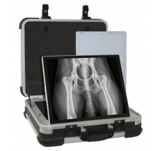 Мобильная беспроводная система для цифровой рентгенографии SCOPE TOUCH
