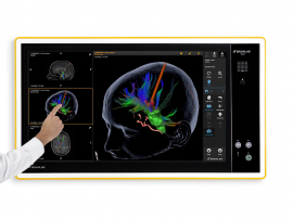 Brainlab BUZZ Digital O.R.